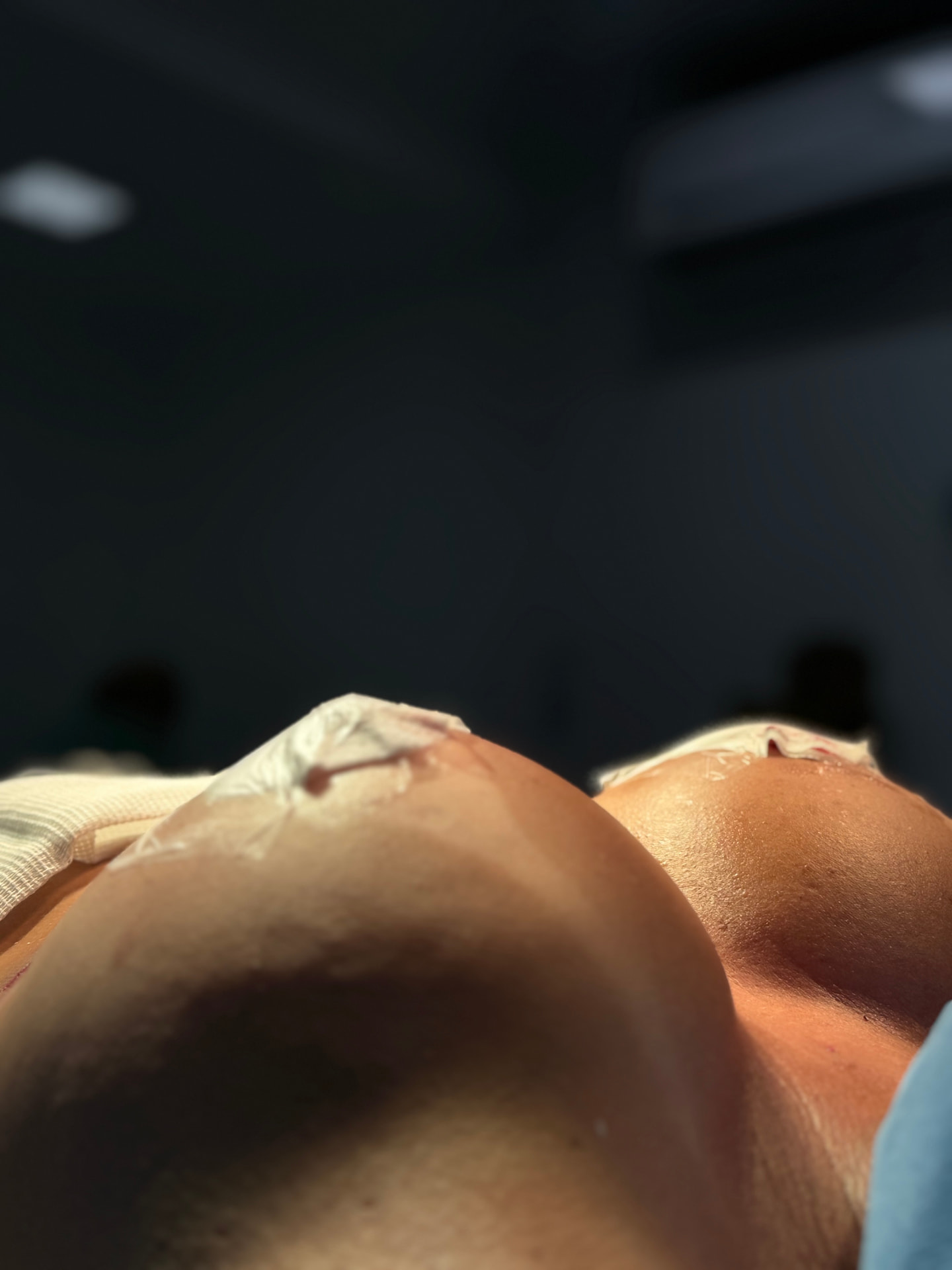 Registro do cuidado durante a cirurgia